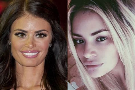 chloe sims before surgery